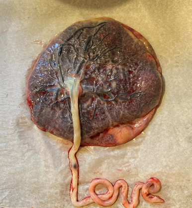 Placenta Encapsulation Specialist Training