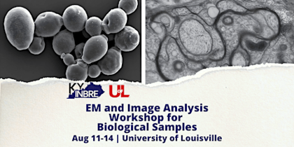 KY INBRE Electron Microscopy and Image Analysis Workshop for Biological Sam